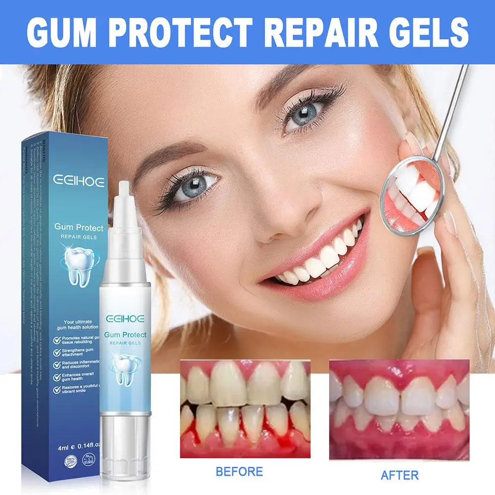 Gum Repair Gel Rebuilding Strengthen Whiten Remove Tooth Stains Anti Gingival Inflammation Recession Bad Breath Protect Oral Gel