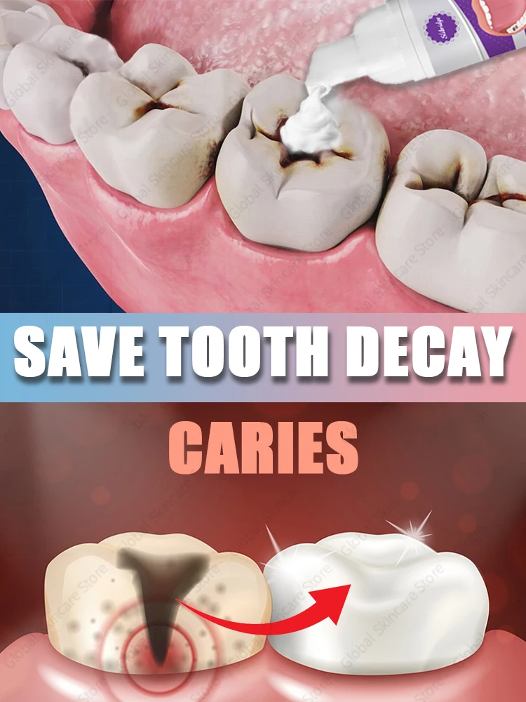 Teeth Decay repair