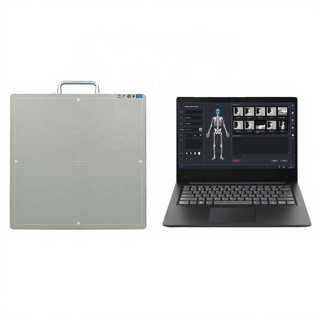 Portable Medical Digital Xray DR FPD Wireless CSI RX Digital X-ray Flat Panel Detector for Human and Veterinary