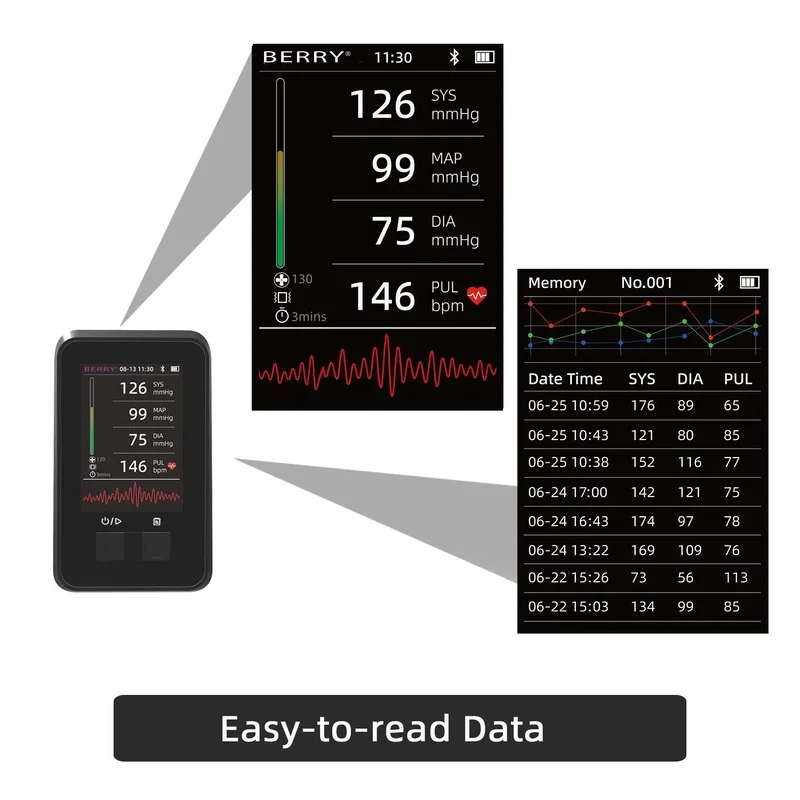 Digital Veterinary Blood Pressure Monitor Electronic BP Tester For Small Animal Pets