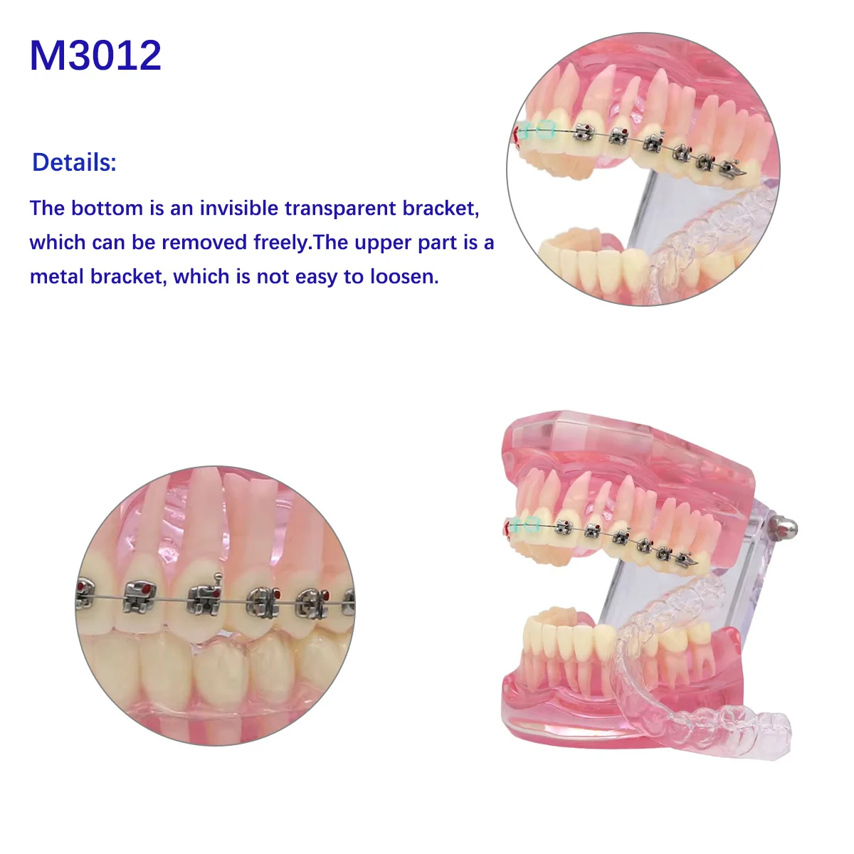 Dental Orthodontics Model With Braces Dental Model With Retainer False Teeth Model For Dentistry Lab