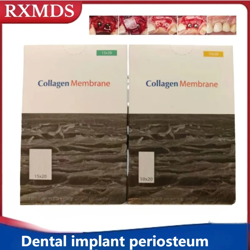 1Box Dental Materials Bone Collagen 3rd Generation Bone Gain GBR Oral Absorbable Biofilm Periosteum Bone Filling Material