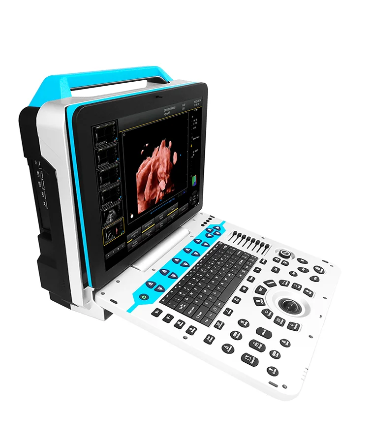 3D-Scanner für tragbare medizinische Geräte für OB/GYN