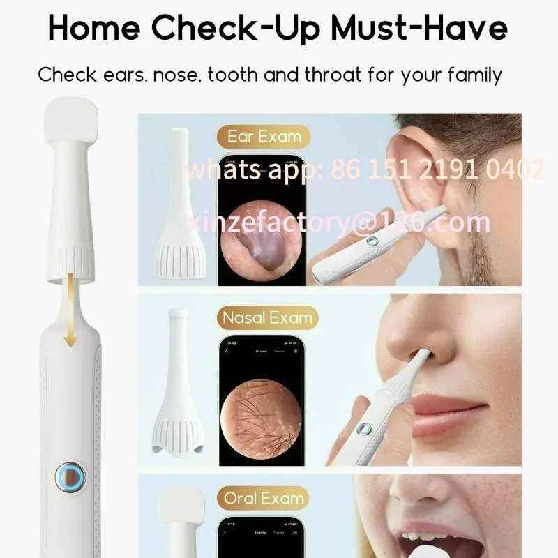 Customizable Visual Ear Spoon Endoscope Intelligent Ear Wag Artifact Rechargeable Suction Ear Picker with Light