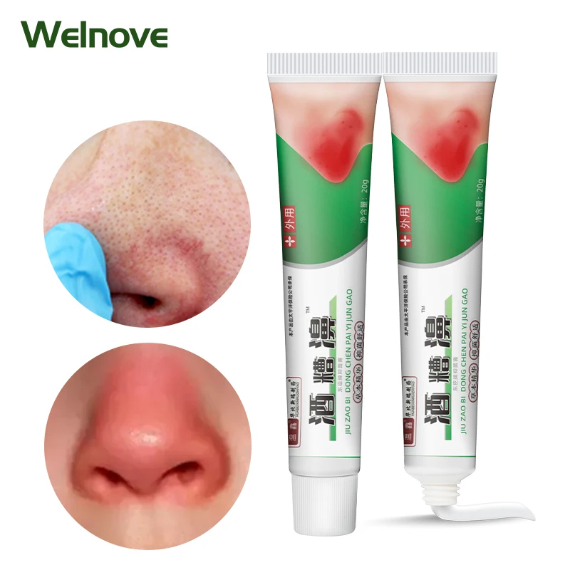 

1Pc 20g Rosacea Treatment Cream Acne Mites Rosacea Cream Remove Nose Skin Redness Swollen Allergy Peeling Blackhead Ointment