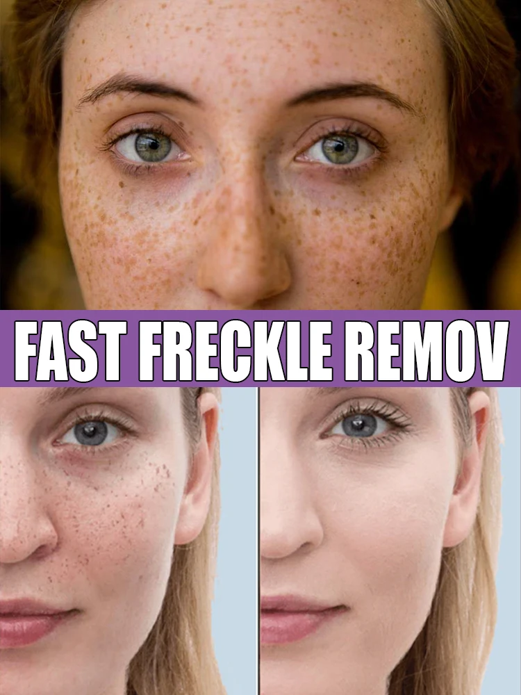 

Laser to Restore your beautiful appearance