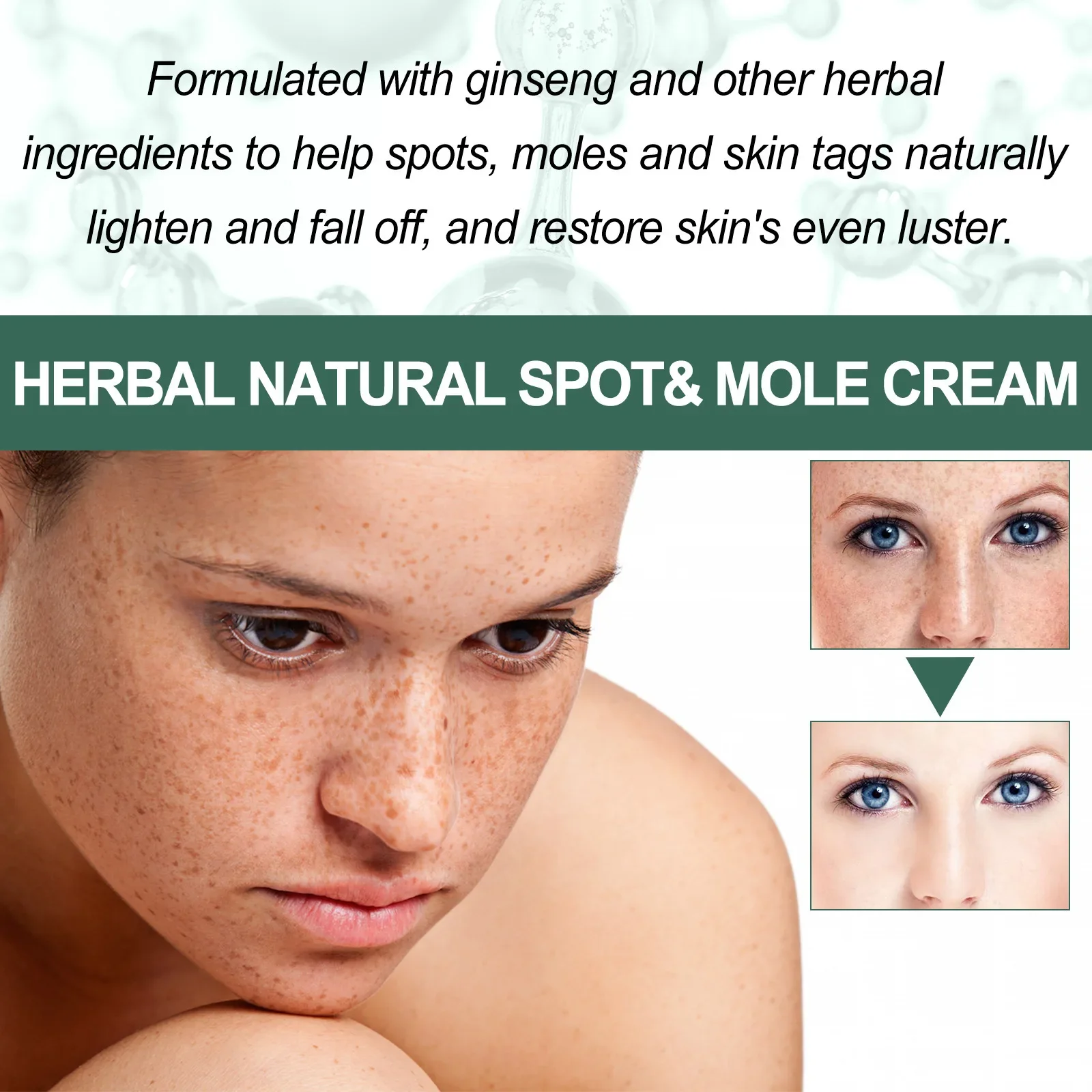 Sdatter Eelhoe Natuurlijke Spot Cream Spot Vervagen Acne Vocht Suppletie Huid Whitening Verheldering Huidverjonging