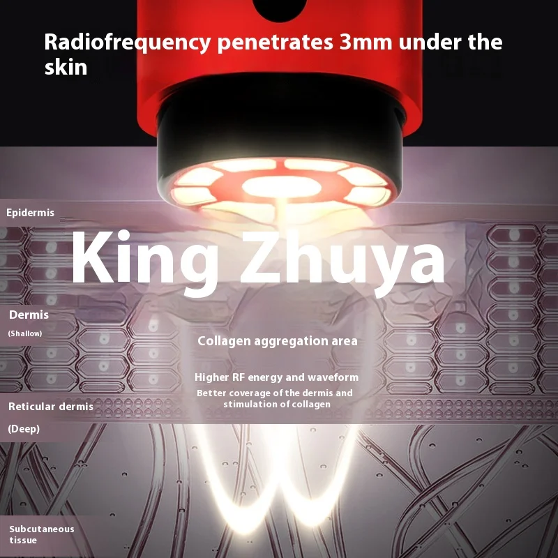 การแปลงความถี่หลายขั้วนําเข้าอุปกรณ์ความงามโฟตอนอุปกรณ์ IPL