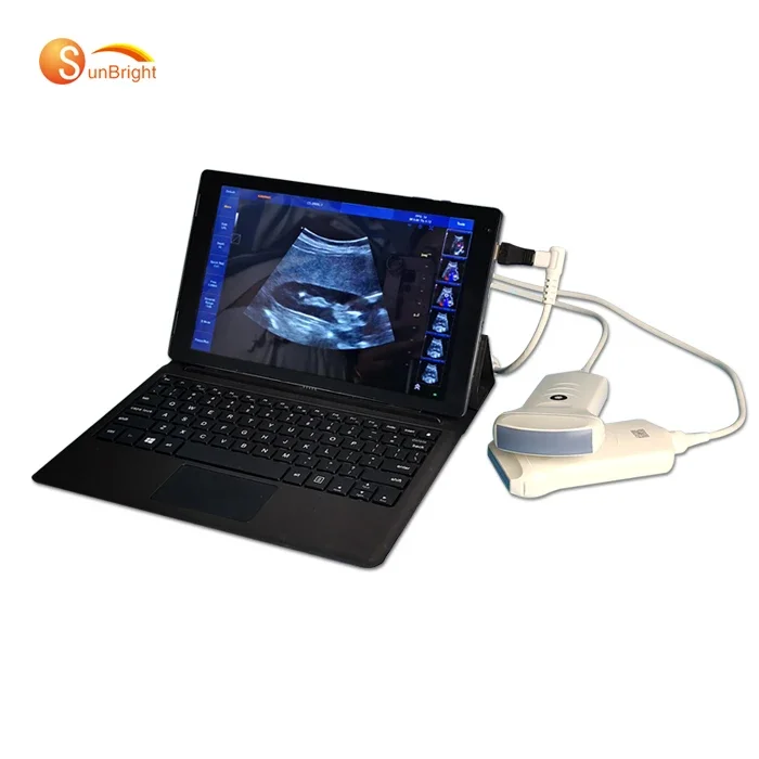 Handheld Color Doppler Ultrasound Scanner Pocket Size Doppler Ultrasound For Windows/Andorid Device