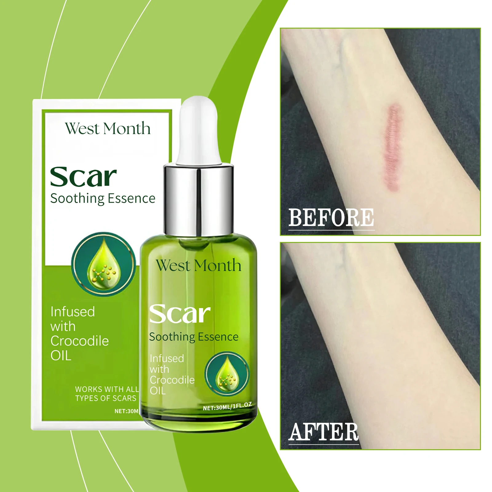 Skin Repair Serum Body Skin Moisturizing Firming and Rejuvenating Care Serum Repair Stretch Marks and Scars Restore Smooth Skin