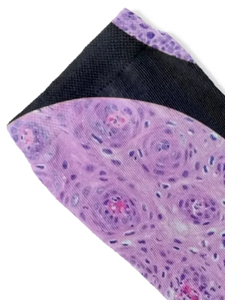 Skin histology, tangential, dysplastic, 200x H&E Socks crazy anime men cotton high quality hiphop Socks Male Women's