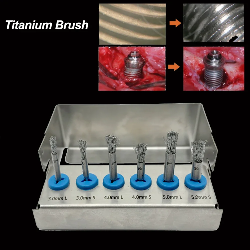 6PCS Sikat Gigi Titanium Berkualitas Tinggi untuk Dekbridemen Peri-Implantitis Pembersihan Permukaan Implan Dapat Diautoklaf