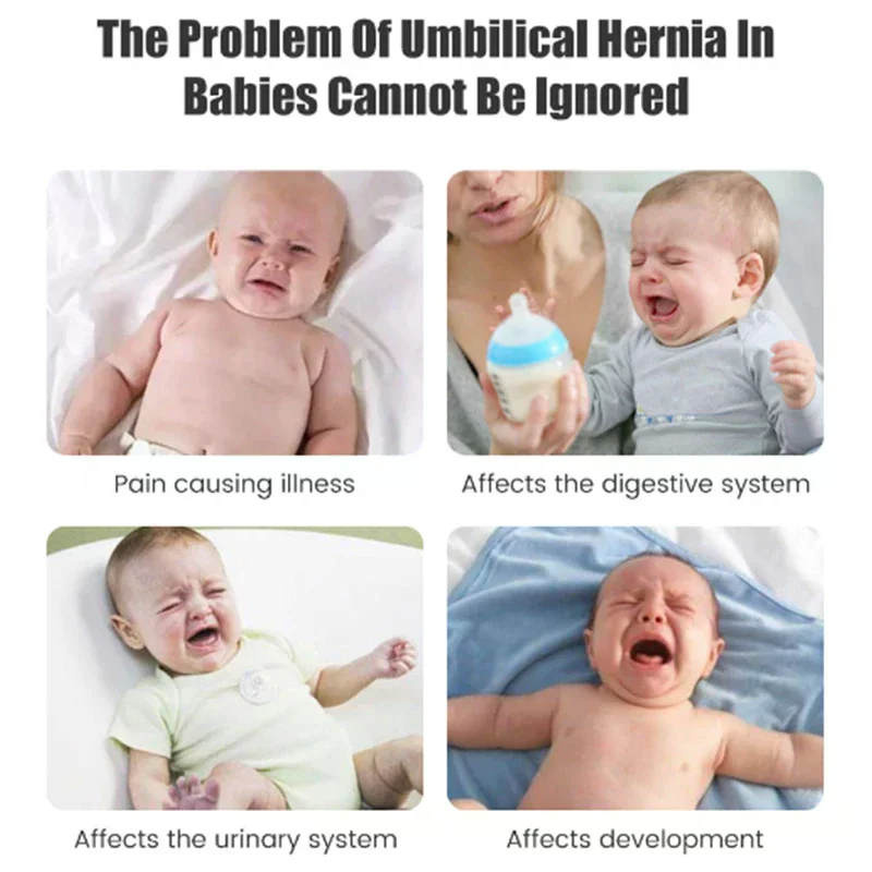 /YOV/Inguinal Umbilical Hernia Belt Navel Support Stickers Treatment Newborn Baby Belly Button With 3 Hernia Pad Infant