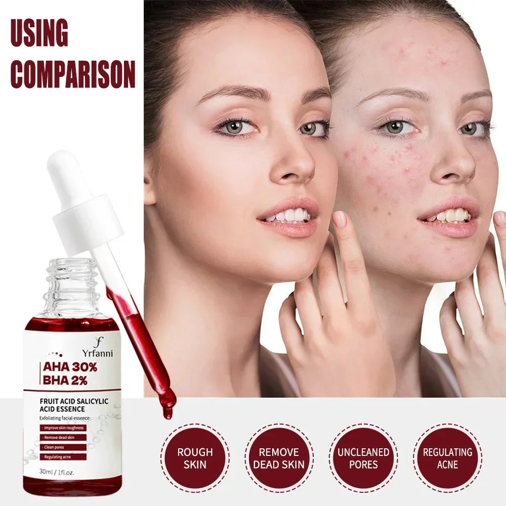 Salicylic Acid Shrink Pores Face Serum Exfoliating Moisturizing Nourishing Smooth Pores Repair Lifting Firming Skin Care Product