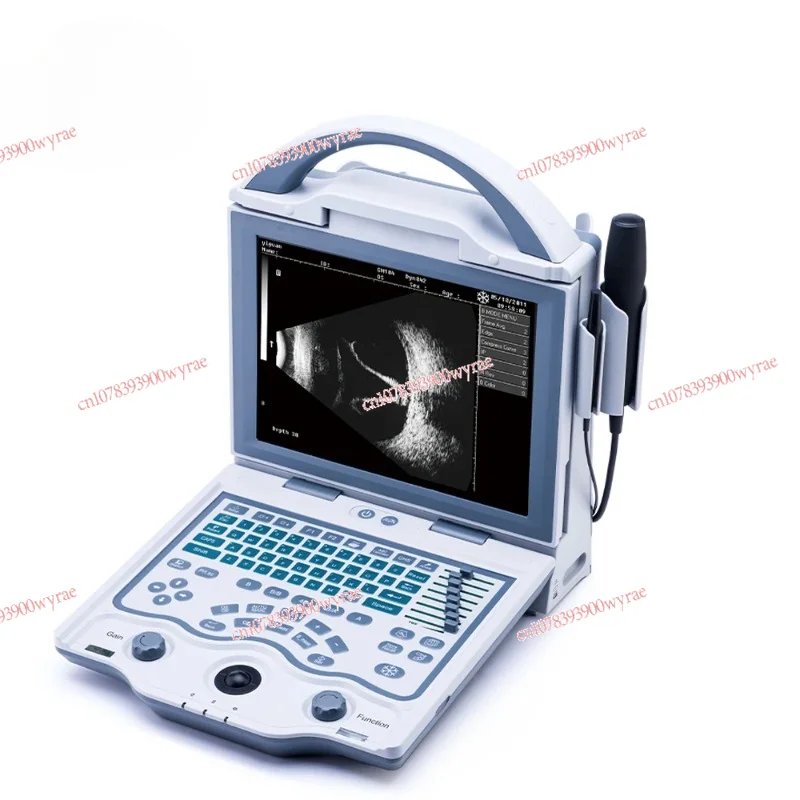 ODU-5 Biometry Accuracy Ophthalmic AB Scan Ultrasound Scanner