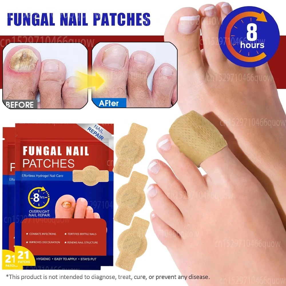 21/42pcs Toenail Fungus Treatment Stickers Fungus Removal Nail Repair Patch Ingrowning Toenail Corrector Repair Patch Foot Care