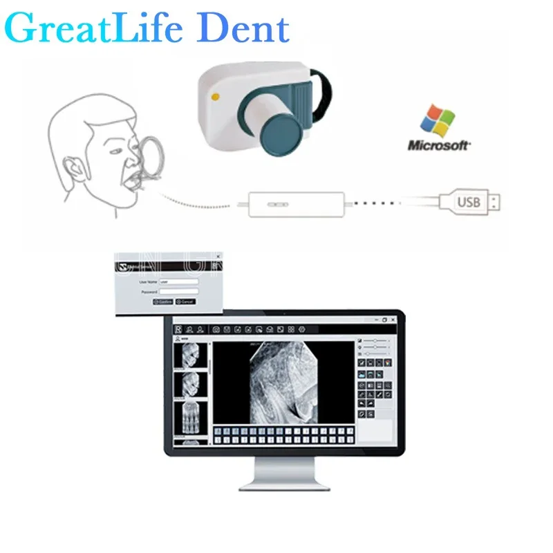 GreatLife Sensore digitale a raggi X dentale Sistema di imaging a raggi X dentale portatile impermeabile Sensore RVG per nave da dentista dal Messico