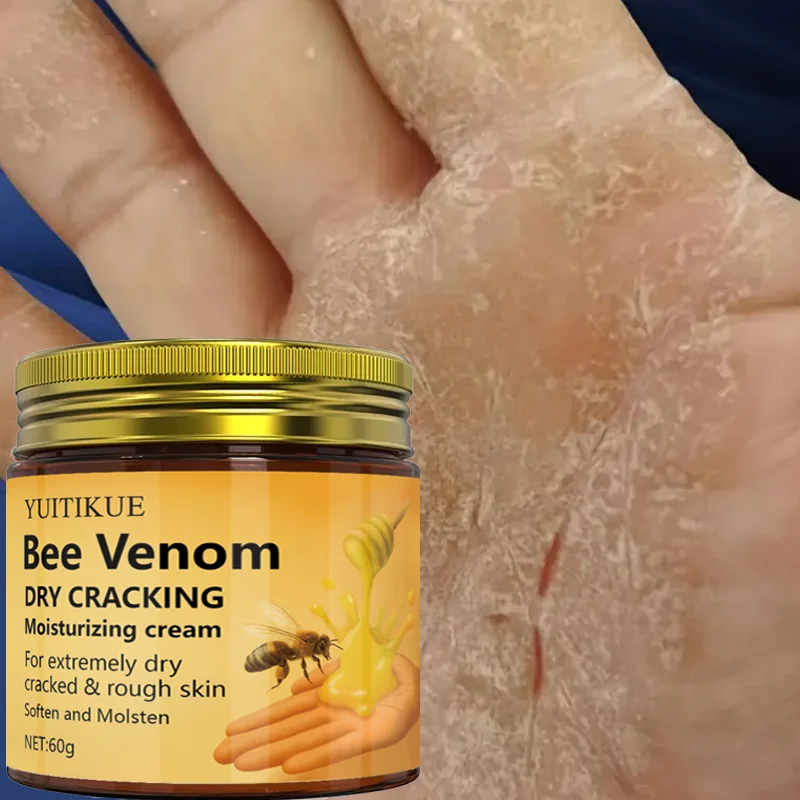 Die Feuchtigkeitscreme von YUITIKUE Bee Venom eignet sich für äußerst trockene, rissige und raue Haut. Weich und befeuchtet.