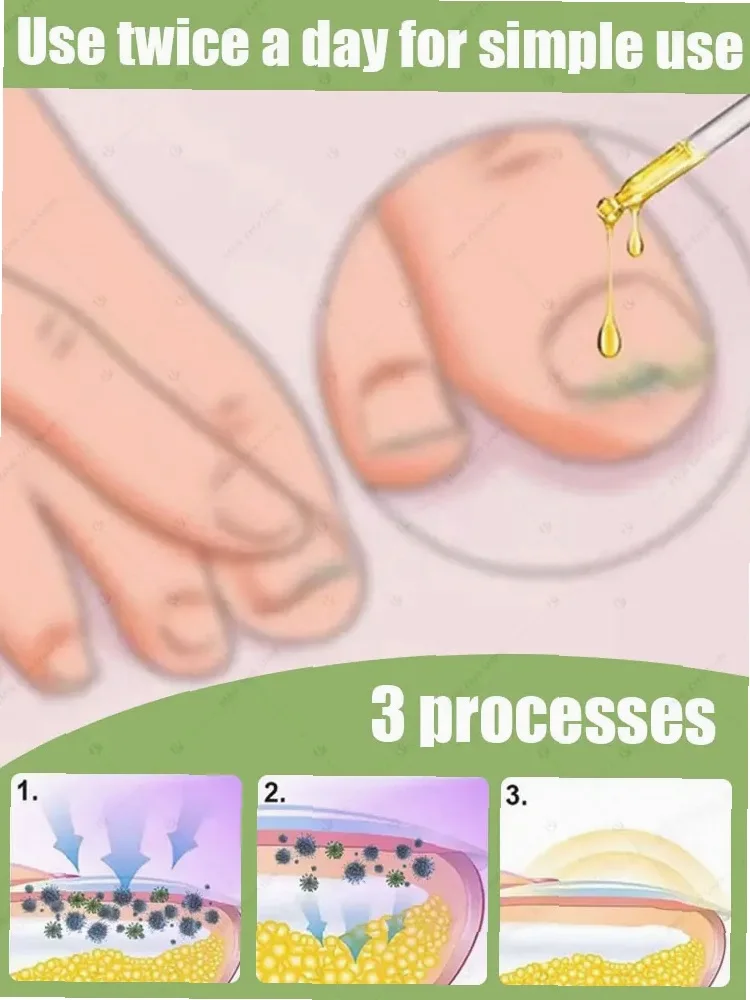 Thumbnail 4 - #50 Nail Care Deals & Discounts