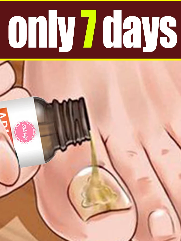 

2026 Spring Sale Electric Foot Care Tool Portable Heel Callus Remover.Nail Fungus Grinding Tool