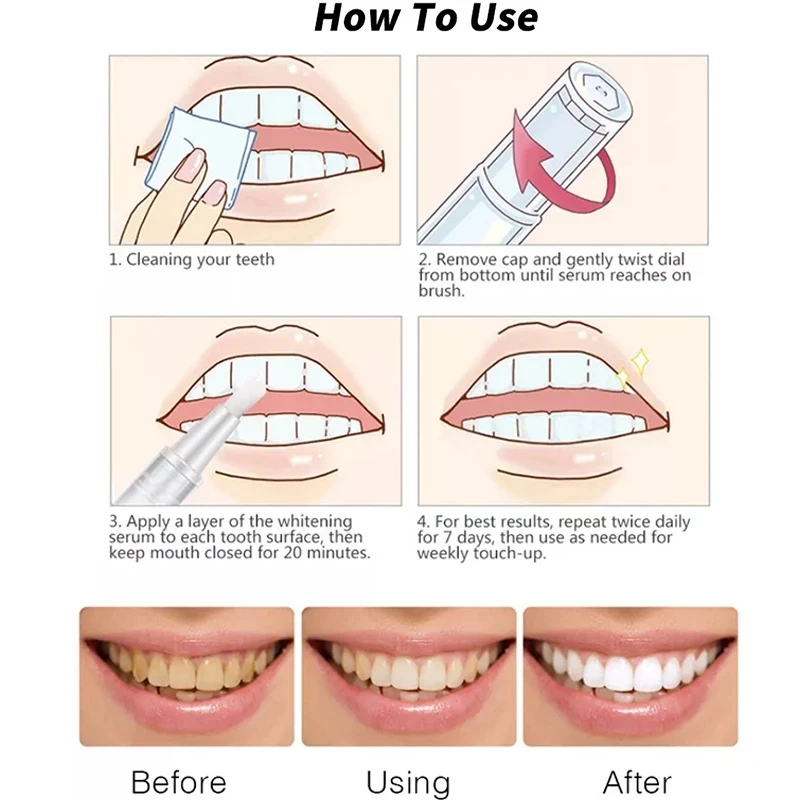 Teeth Whitening Pen Cleaning Pen Beauty Teeth Brightening White Pen Whitening Gel To Remove Yellow Teeth Smoke Teeth Tea Stains