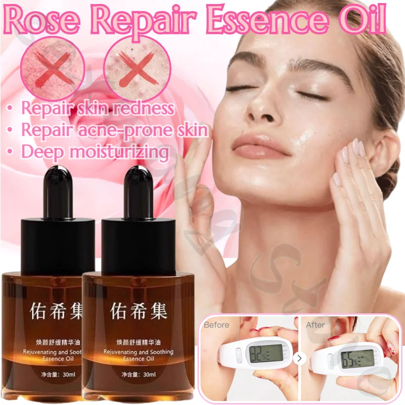 

Rose Multi-purpose Soothing and Calming Essential Oil Strengthens The Barrier and Repairs Red, Sensitive and Acne-prone Skin