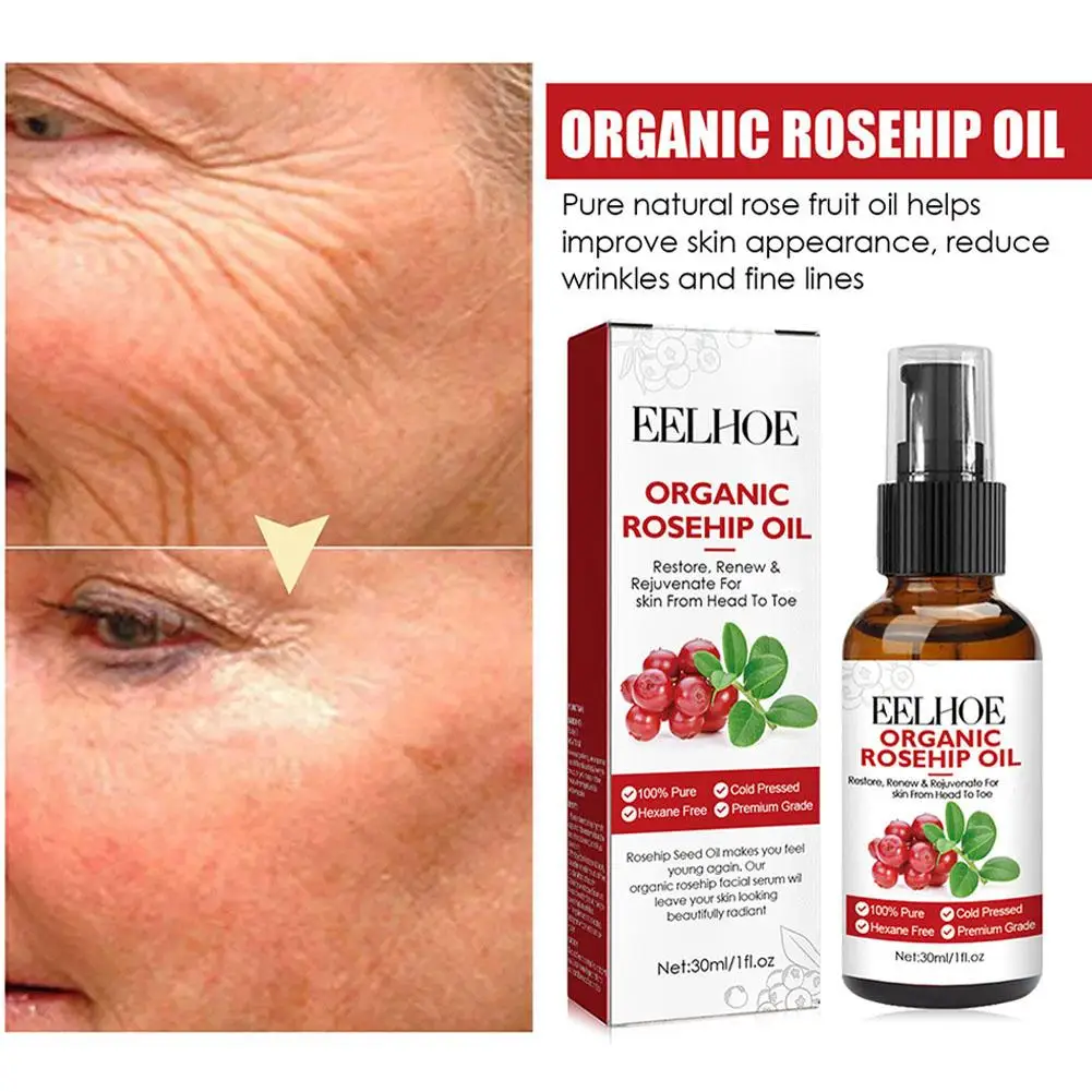 Rose Hip Seed Oil Essence Fade Wrinkle Anti Black Face Oil Oil Natural Moisturizing Hydrating Castor Seed Care Prod Y7z8