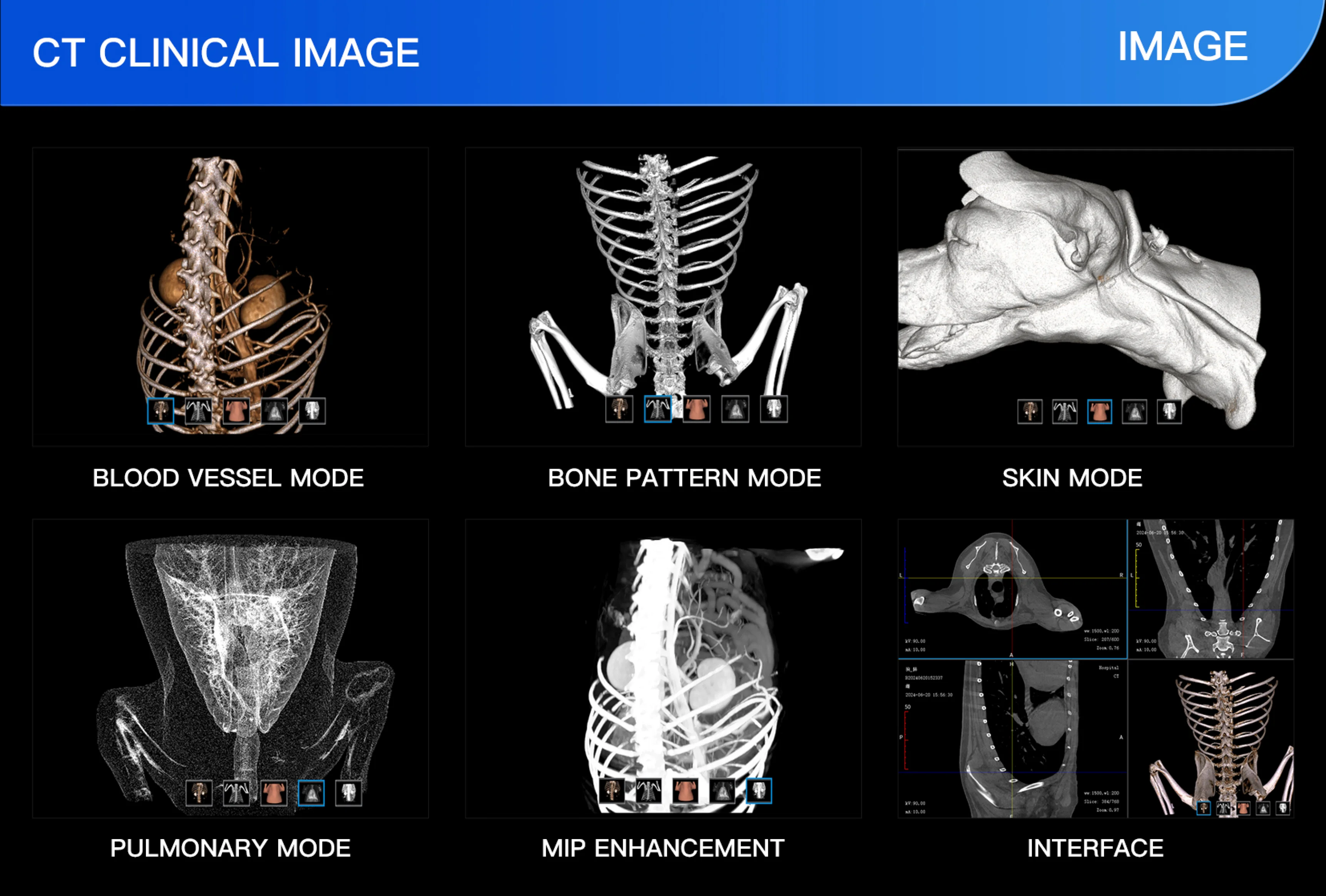 EUR VET Best-Selling Multifunctional Veterinary Equipment CBCT Scanner Static Dynamic DR C-Arm Mode Radiography for Dog Clinics