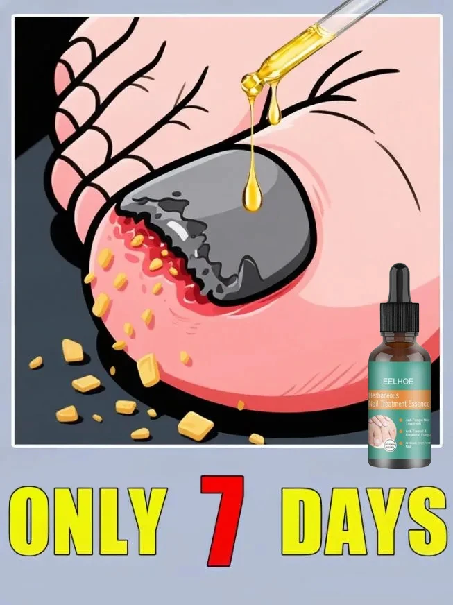 

Say goodbye to onychomycosis, don't let it affect your life, nail care tools