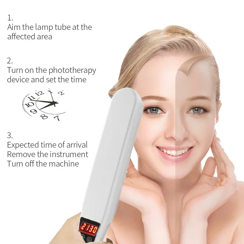 311nm Narrowband UVB Phototherapy Lamp 48cm² Large Coverage Handheld Digital Timer UV Light Home Auxiliary Skin Care for Vitilig - view 4