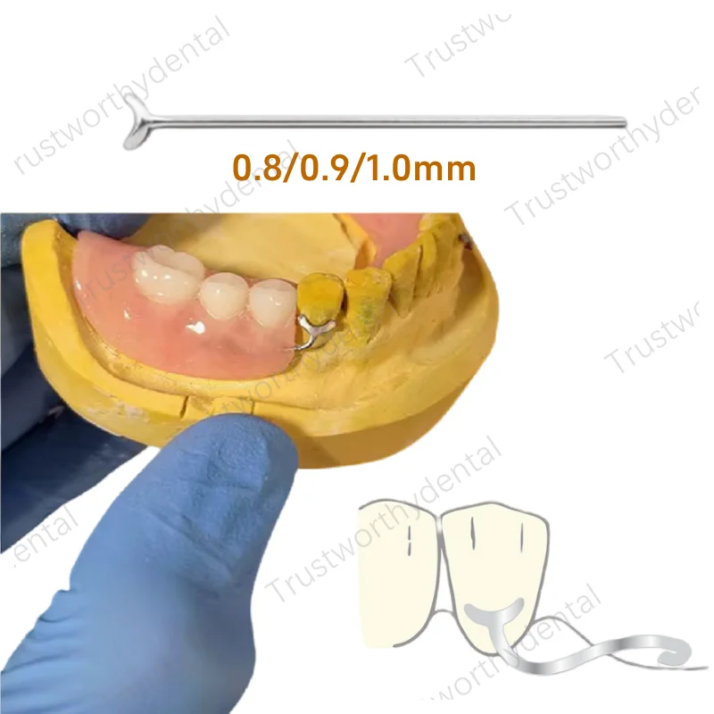 Dental J Clasp Ball Retainer Orthodontic 0.8/0.9/1.0 Oblique Bar Y-Type ScheuTeeth Position Hold