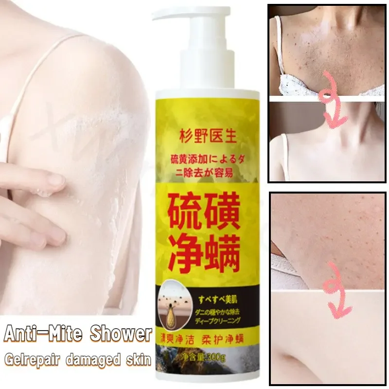 Exfoliating Relieve Back Erythema Deep Cleansing Anti-acne Itching Hydrating Men and Women Remove Mites Sulfur Mite Shower Gel