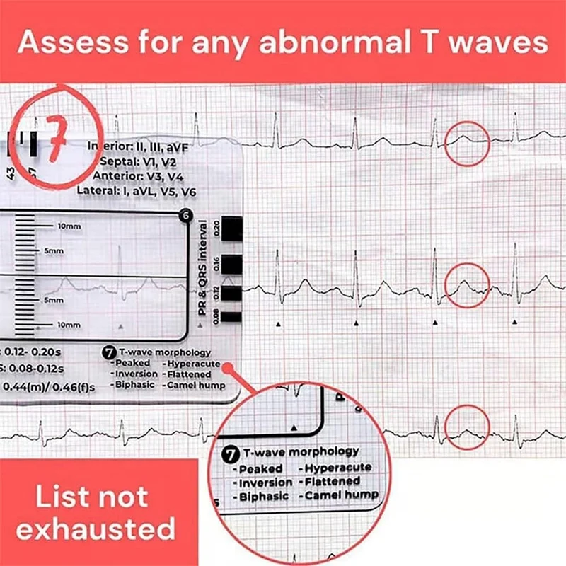 2pcs ECG 7 Step Ruler,ECG 7 Step Ruler for ECG/EKG Interpretation,ECG Reference Guide Ruler,EKG Calipers Measuring Tool-ABFB