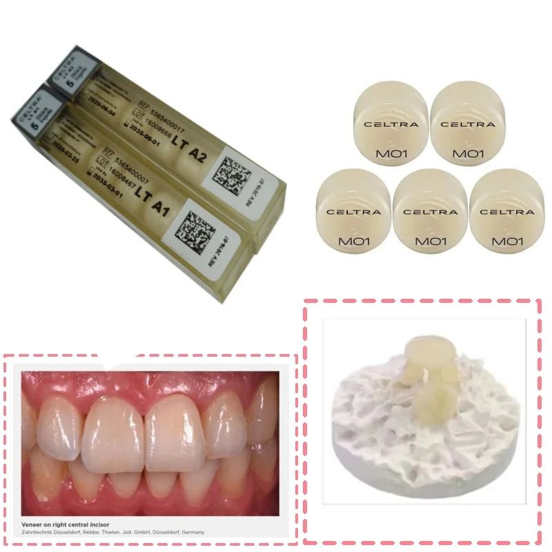 5Pcs/Box HT/LT Sirona Dental Celtra Press Ingots ZLS Zirconia-Reinforced Dental Glass Ceramic Lithium Silicate