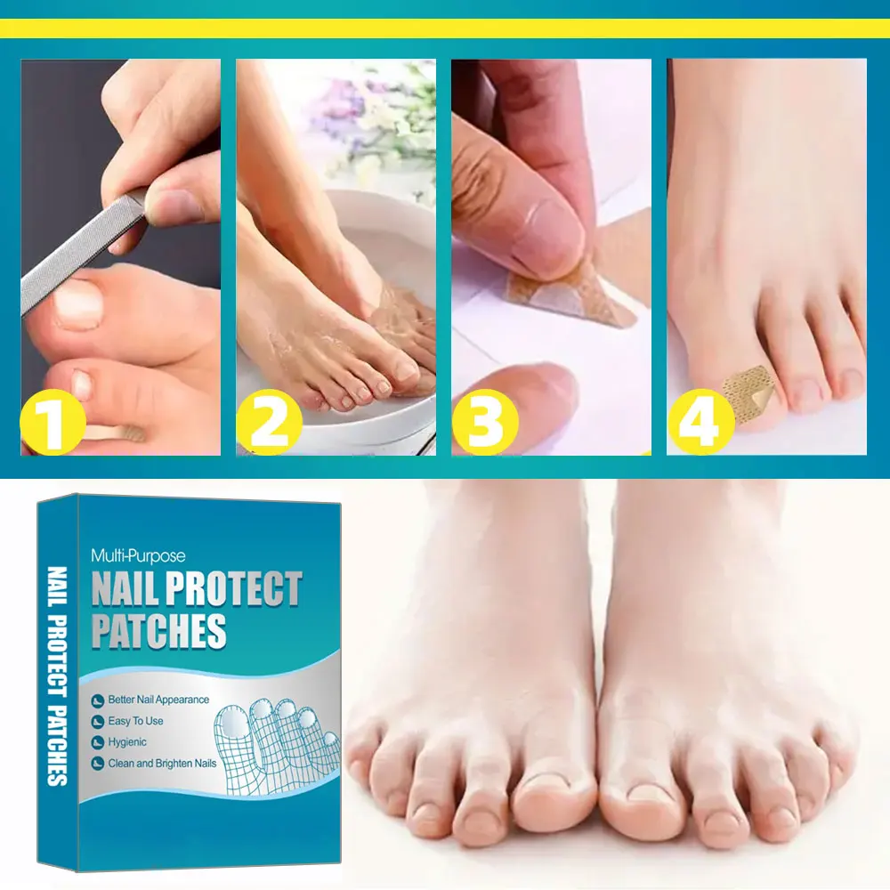 브라운 네일 재생 패치, 발톱 및 손톱용, 접착제가 없는 네일 스티커, 전문 페디큐어 도구 키트
