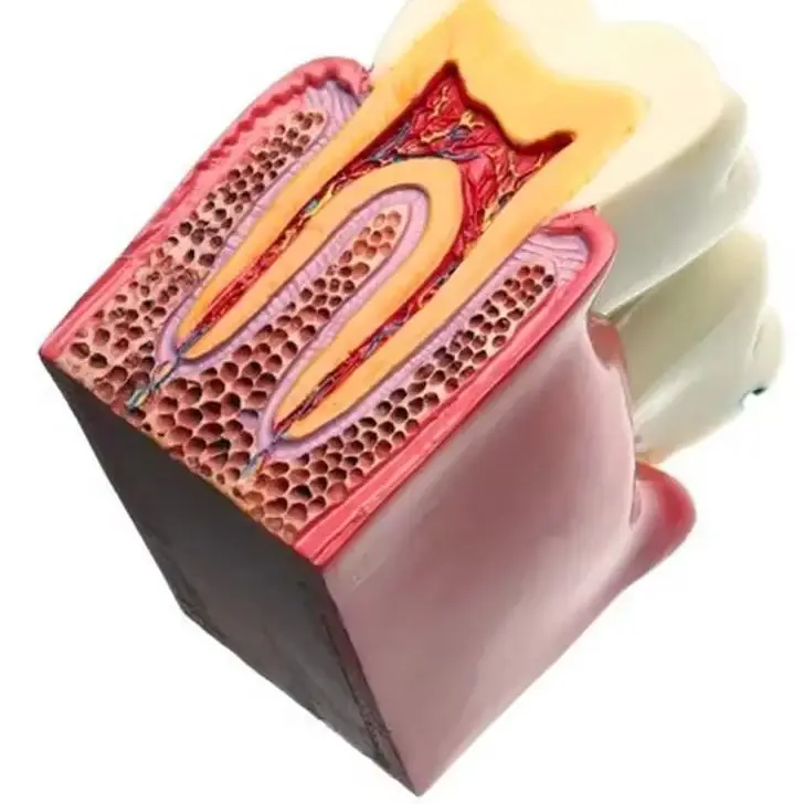 

Dental Teaching Model Dental Materials Lab Teeth Model 6 Times Caries Comparation Study Models