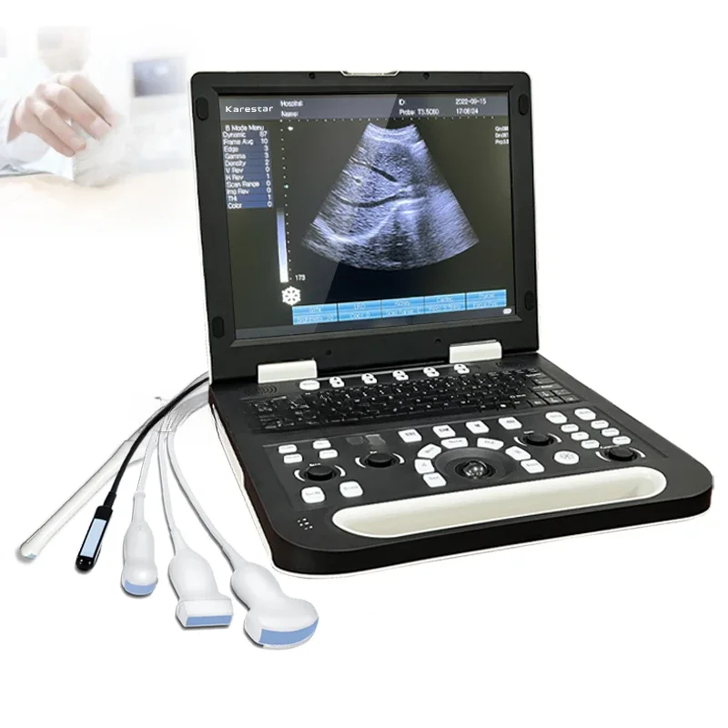 Ultrasound Machine Veterinary Instrument   for Animal/cattle Cow Horse Goat Use