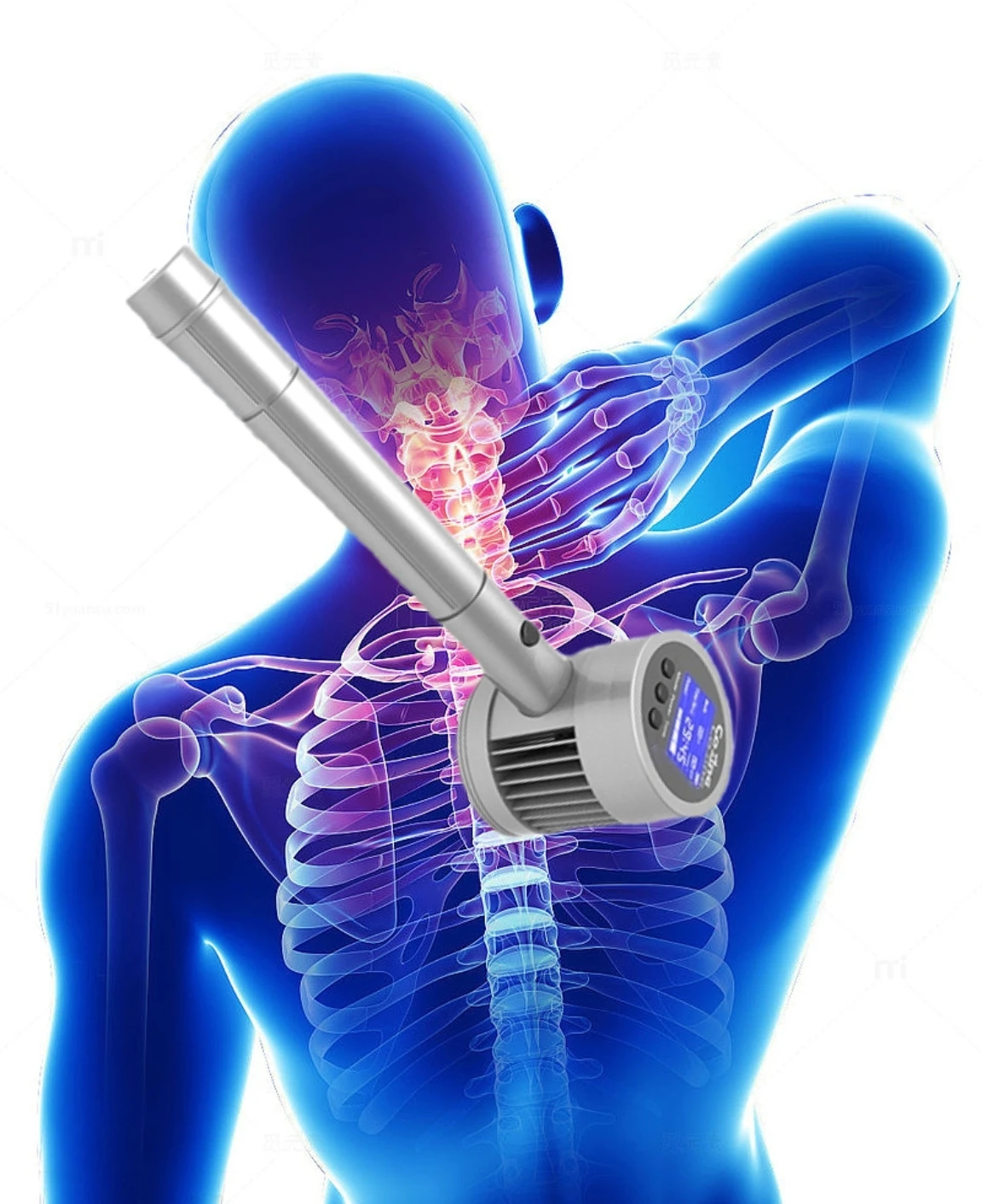 

Профессиональный аппарат для физиотерапии LLLT с холодным лазером, двойной длиной волны 650 нм и 808 нм, для лечения боли в плече, теннисного локтя, растяжений