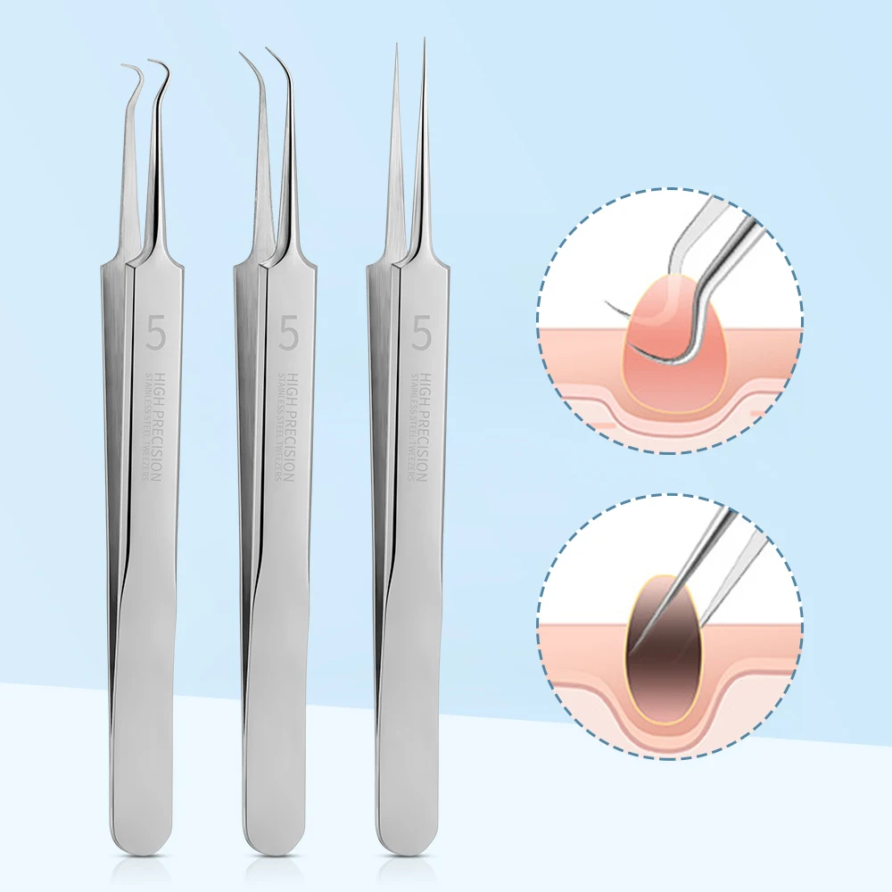 Acne Needle Set 3Pcs Stainless Steel Cell Clip Acne Clip Acne Needle Blackhead Removal Beauty Tools Skin Refreshing And Delicate