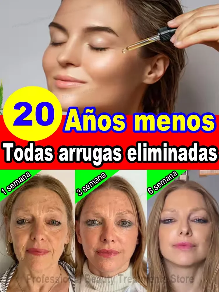 Say goodbye to wrinkles and be 20 years younger