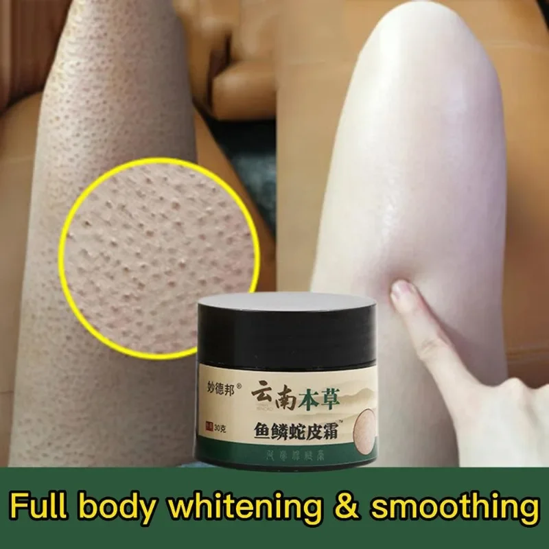 Chicken Skin Repair Cream Treat Hair Follicle Dark Spots Remove Large Pores Moisturizing Smooth Essence