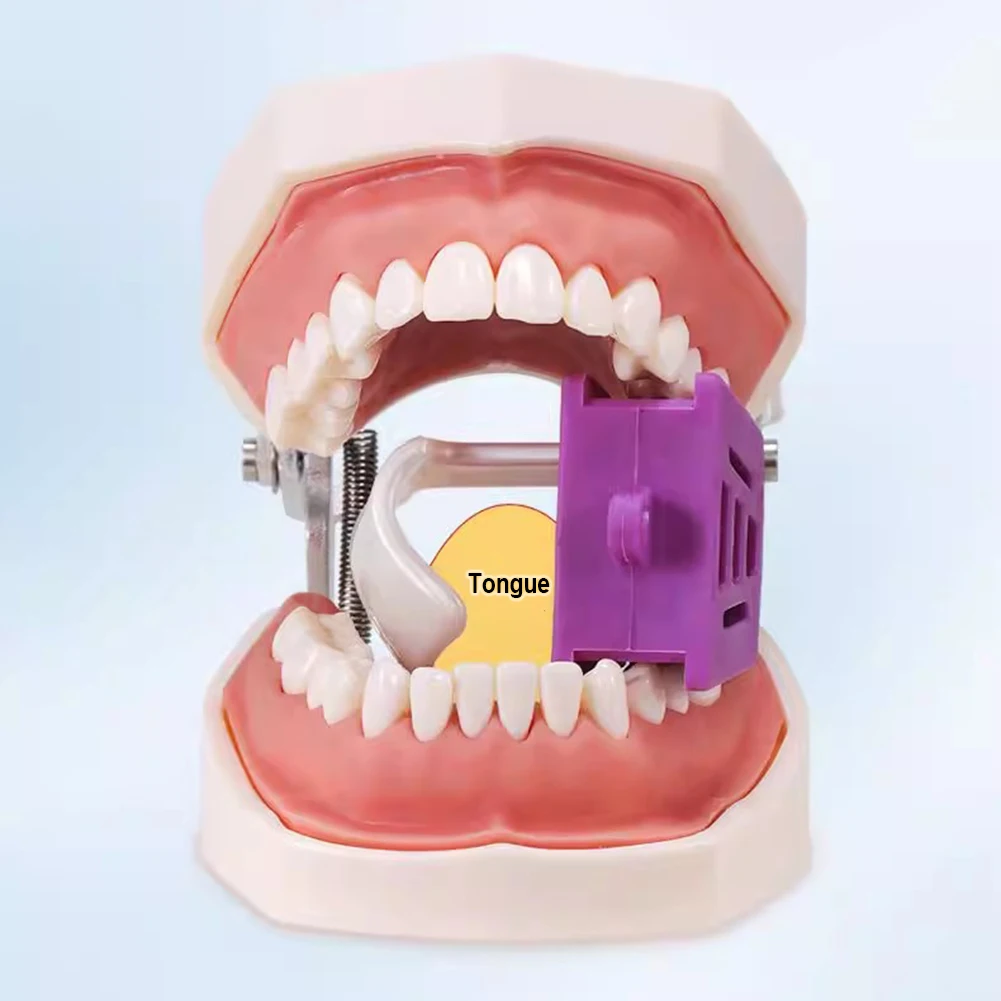 S/M/L Dental Treatment Tool Set Cheek Retractor Tongue Guard Silicone Mouth Opener Occlusal Pad Teeth Props Intraoral Bite Block