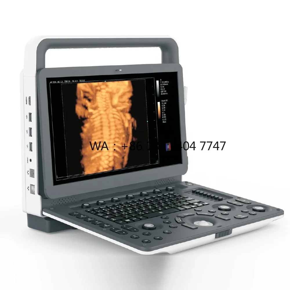 Ecógrafo Portátil 4D para Veterinaria, Máquina de Ultrasonido Veterinario Doppler
