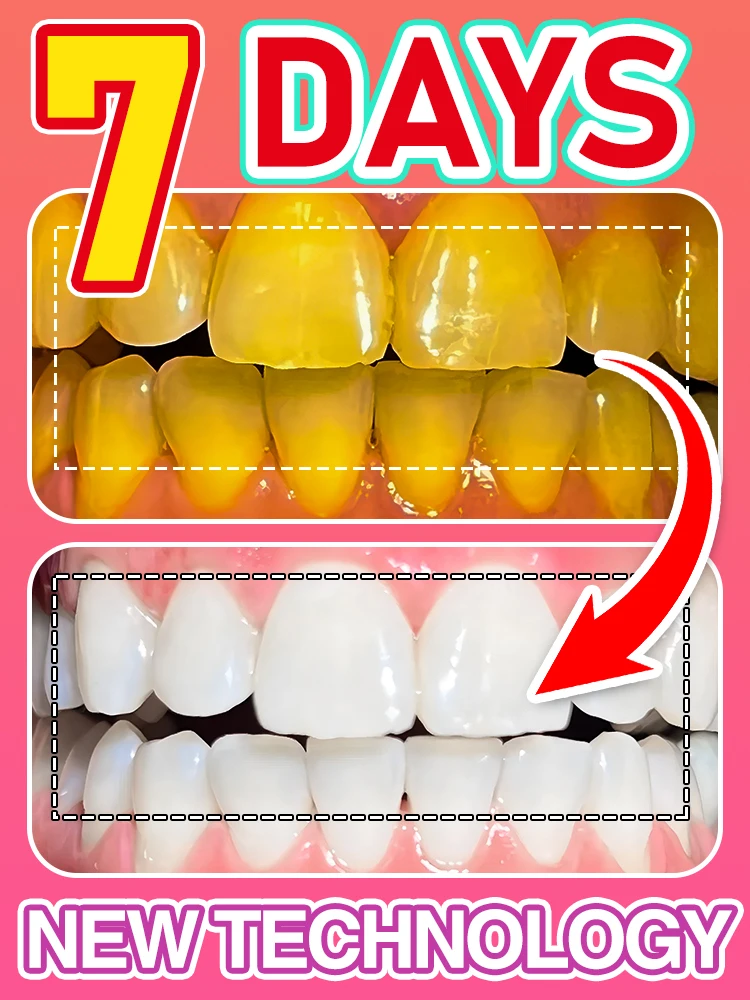 

Quick Dental calculus Removal mousse Teeth Whitening Permanent Dental Foam Removal