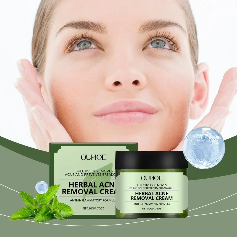 Crema para eliminar el acné a base de hierbas, elimina puntos negros cachondos, reduce los poros, Reduce las imperfecciones, Control de aceite antiinflamatorio, suero para el cuidado Facial