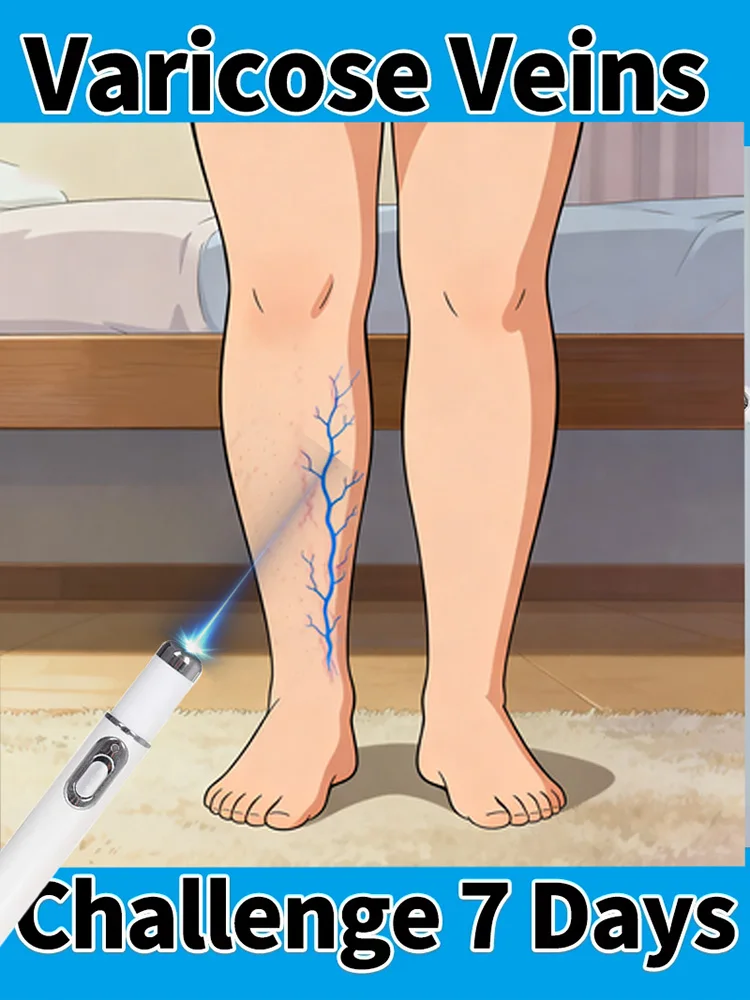 

Модернизированная версия инструмента второго поколения 2025 года, лазерный ремонт синего света, варикозное расширение вен