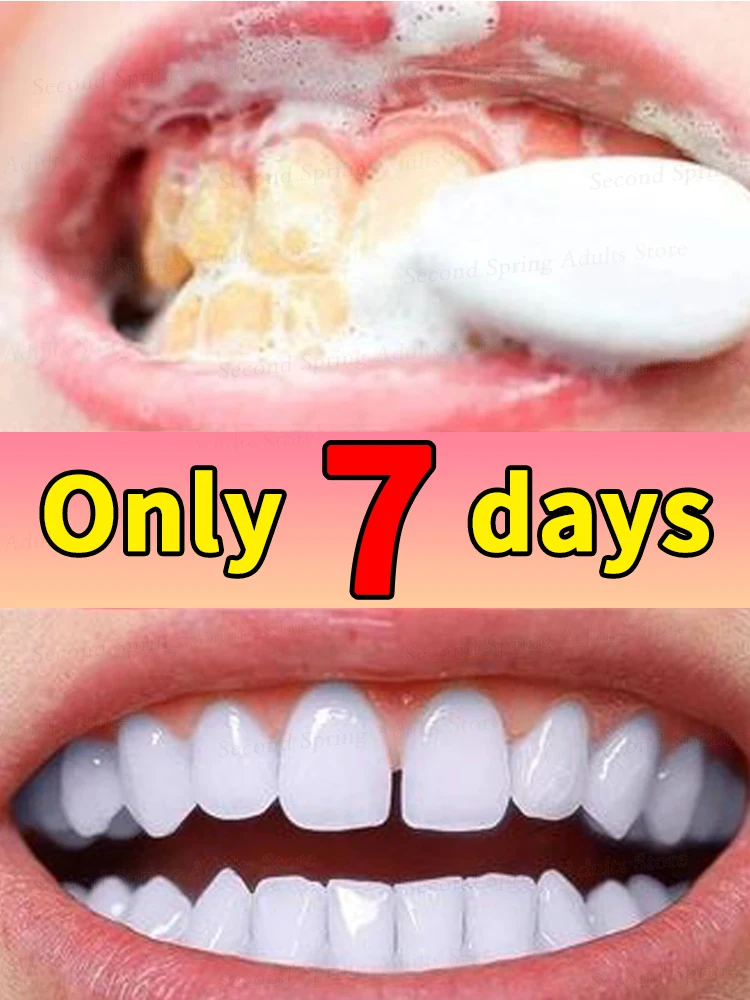 Probiotic tartar Removing Plaque Stains Yellow Teeth Stains Brighten Whiten Fresh Breath dental Hygiene Health Care