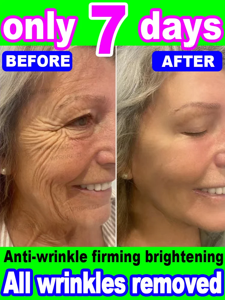 

20 years younger, 100% wrinkles disappear