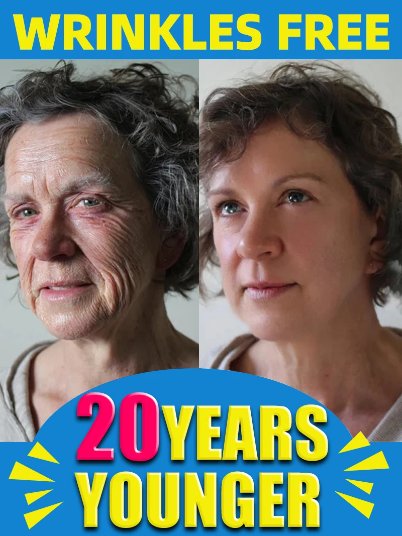 Deep wrinkles wrinkle free