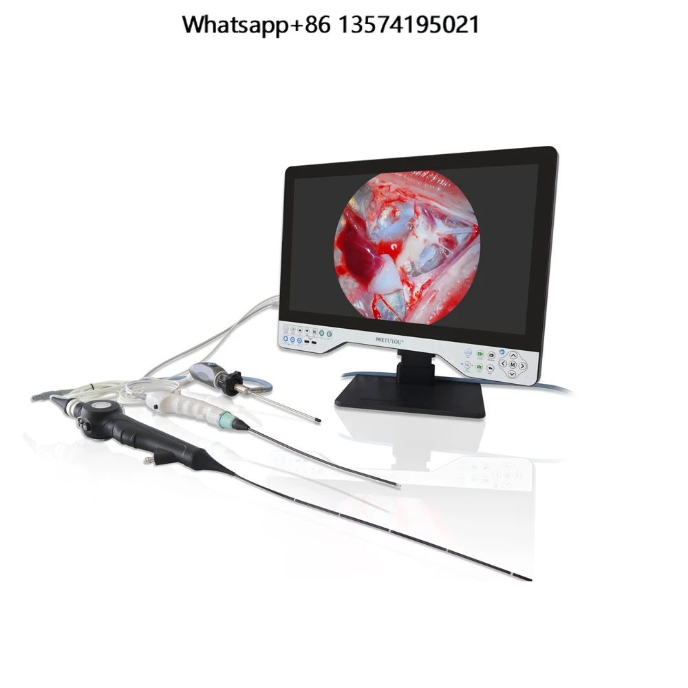 TU-24LSD1E Video Endoscope ENT Endoscope HD for Otolaryngology Rhinoscope Sinuscope Laryngoscope